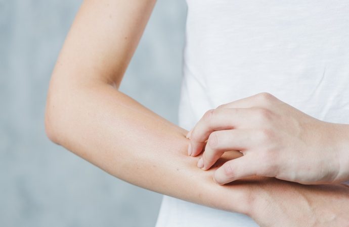 Jak leczyć atopowe zapalenie skóry?