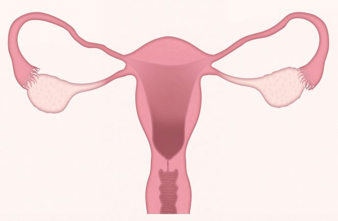Endometrioza – jak ją rozpoznać i jak leczyć?
