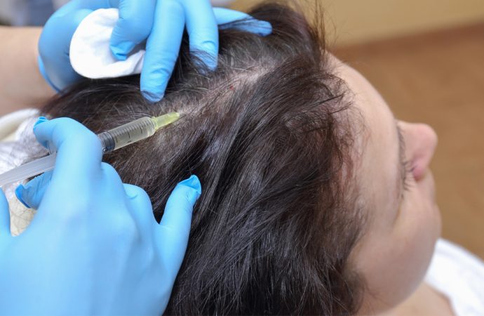 Trycholog – pomoc przy wypadających włosach