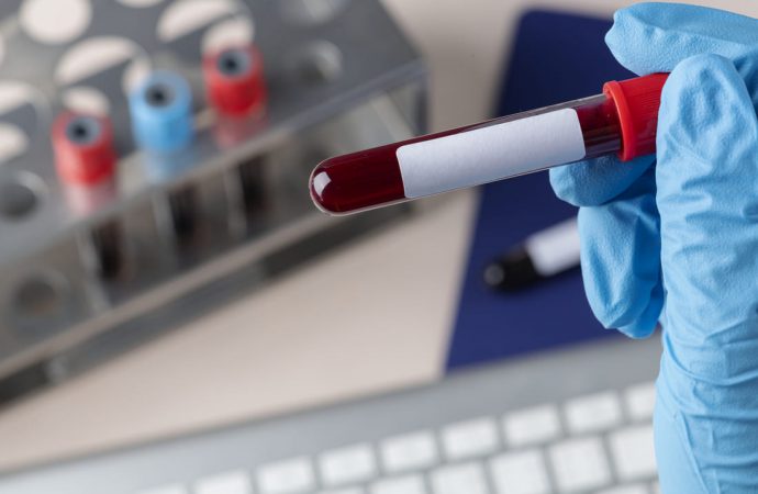 Kiedy warto się udać na badania krwi?